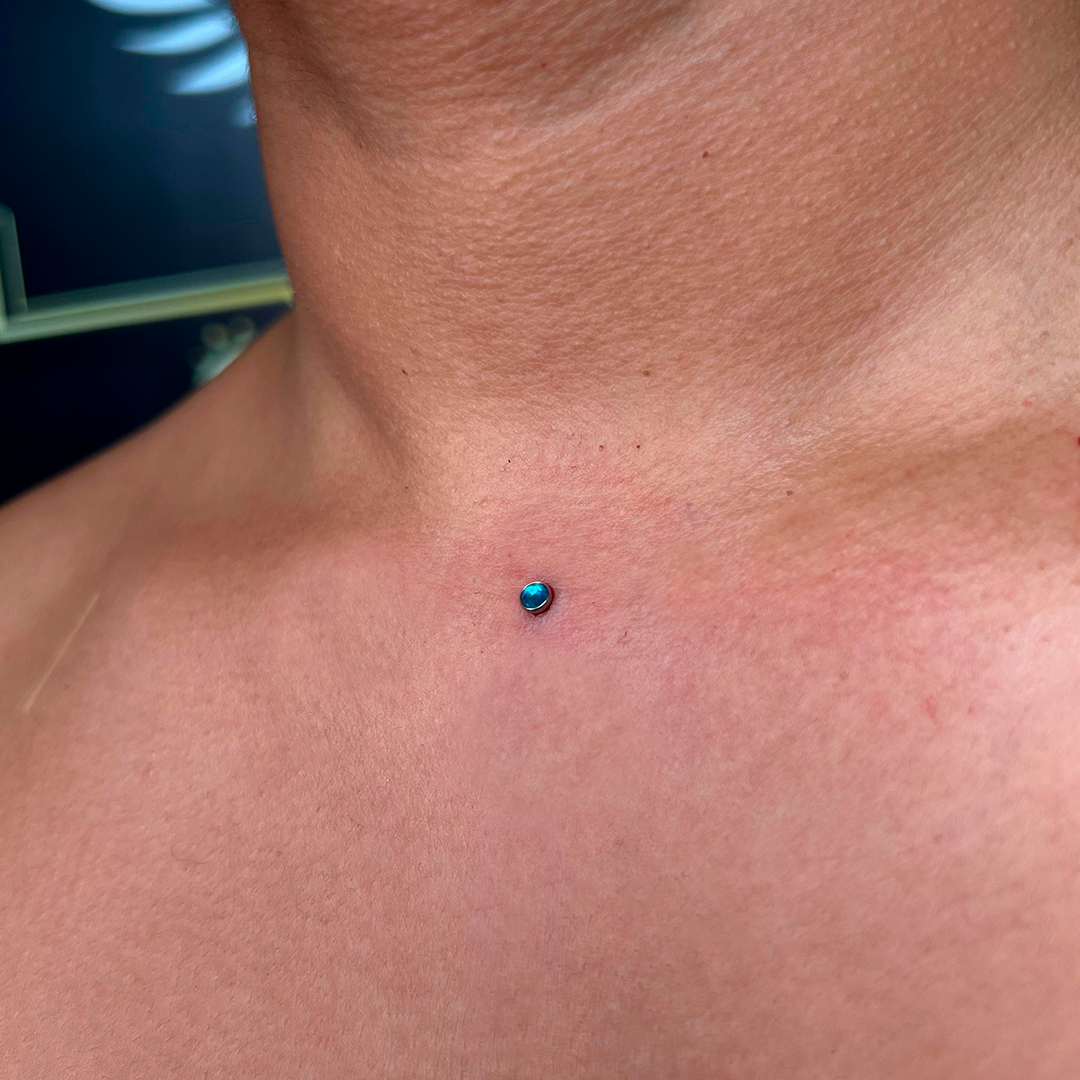 MICRODERMAL – ASTM F136 TITANIUM