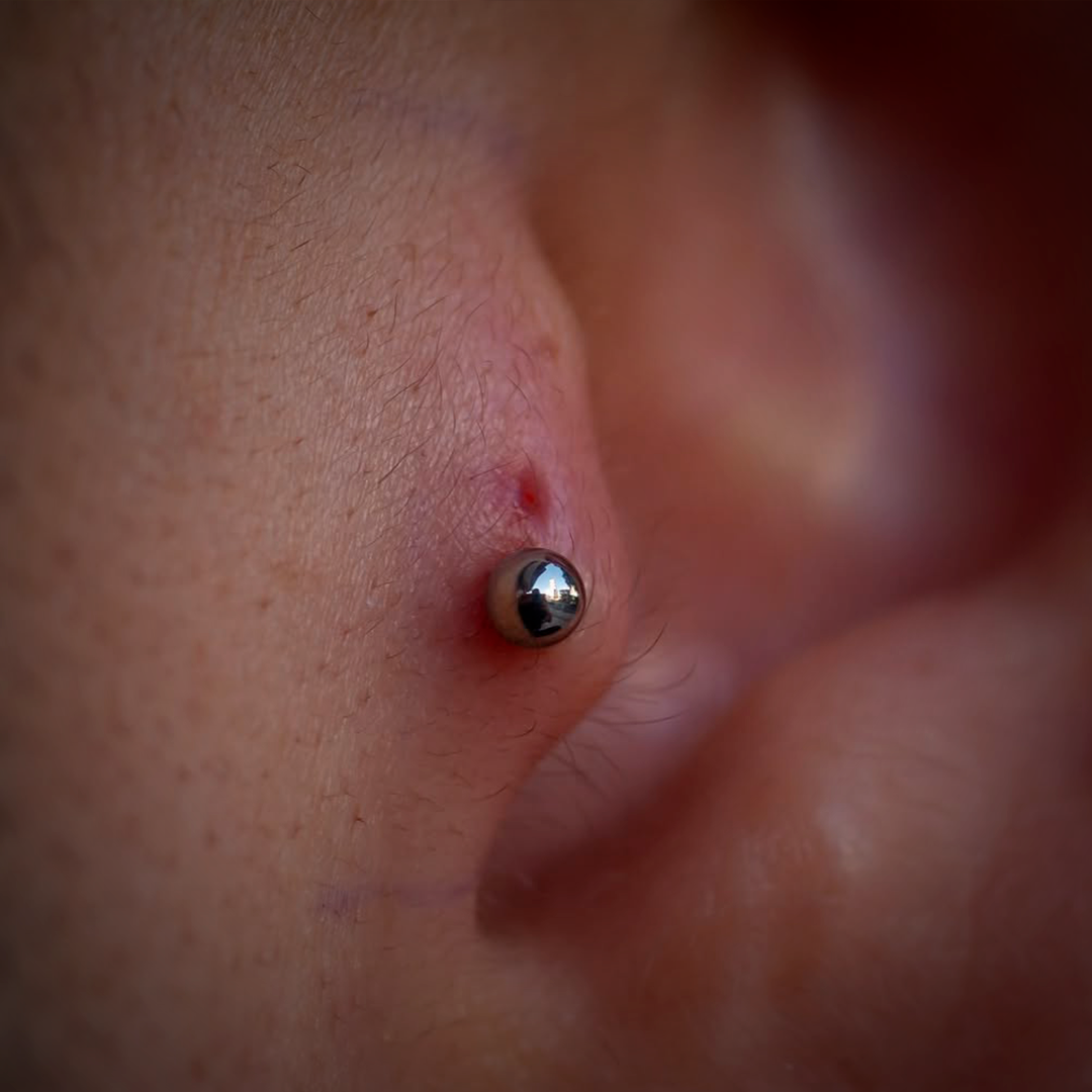 LABRET BALL - ASTM F136 TITANIUM